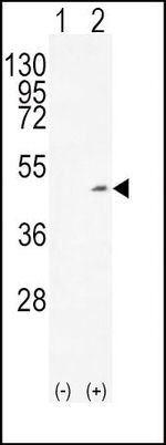 Alcohol Dehydrogenase 1C Antibody in Western Blot (WB)