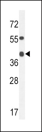 ADH4 Antibody in Western Blot (WB)