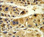 ADH6 Antibody in Immunohistochemistry (IHC)