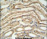 ADH7 Antibody in Immunohistochemistry (IHC)