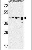 ADH7 Antibody in Western Blot (WB)