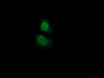 ADI1 Antibody in Immunocytochemistry (ICC/IF)