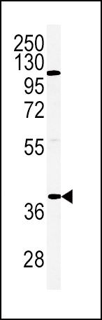 Adiponectin Receptor 2 Antibody in Western Blot (WB)