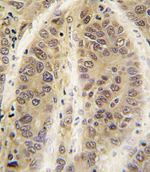 Adenosine Kinase Antibody in Immunohistochemistry (IHC)
