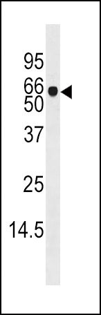 Adenosine Kinase Antibody in Western Blot (WB)