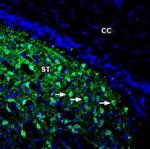 DARPP32 Polyclonal Antibody