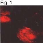 alpha-1a Adrenergic Receptor Antibody in Immunohistochemistry (IHC)