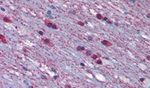 alpha-1a Adrenergic Receptor Antibody in Immunohistochemistry (Paraffin) (IHC (P))