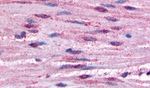 alpha-1b Adrenergic Receptor Antibody in Immunohistochemistry (Paraffin) (IHC (P))