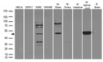 ADRA2A Antibody in Western Blot (WB)