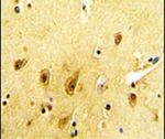 beta-2 Adrenergic Receptor Antibody in Immunohistochemistry (IHC)