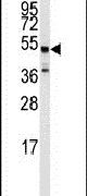 beta-2 Adrenergic Receptor Antibody in Western Blot (WB)