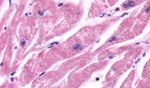 beta-2 Adrenergic Receptor Antibody in Immunohistochemistry (Paraffin) (IHC (P))