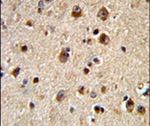 GRK3 Antibody in Immunohistochemistry (IHC)