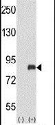 GRK3 Antibody in Western Blot (WB)