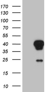AEBP2 Antibody in Western Blot (WB)