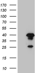 AEBP2 Antibody in Western Blot (WB)