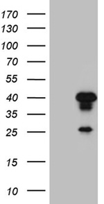 AEBP2 Antibody in Western Blot (WB)