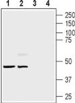 Endothelin Receptor B Polyclonal Antibody