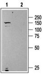 Urotensin II Receptor Polyclonal Antibody