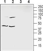 Ephrin-B1 (extracellular) Polyclonal Antibody