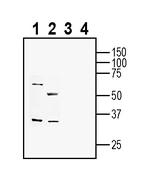 Ephrin-B2 (extracellular) Antibody in Western Blot (WB)