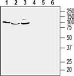 GPER1/GPR30 (extracellular) Polyclonal Antibody