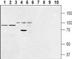 EMR1 (ADGRE1) (extracellular) Antibody in Western Blot (WB)