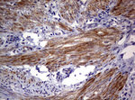AFAP1 Antibody in Immunohistochemistry (Paraffin) (IHC (P))