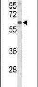 Afamin Antibody in Western Blot (WB)