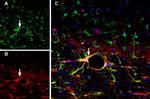 GFAP Antibody in Multiplex Immunohistochemistry (mIHC)