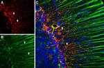 GFAP Antibody in Multiplex Immunohistochemistry (mIHC)