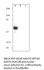 Alpha 1 Fetoprotein Polyclonal Antibody