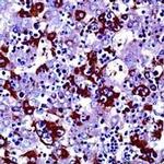 AFP Antibody in Immunohistochemistry (Paraffin) (IHC (P))
