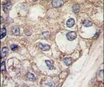 AFP Antibody in Immunohistochemistry (IHC)