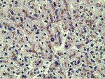 AFP Antibody in Immunohistochemistry (Paraffin) (IHC (P))