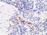 AFP Antibody in Immunohistochemistry (Paraffin) (IHC (P))