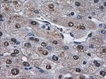 AFP Antibody in Immunohistochemistry (Paraffin) (IHC (P))