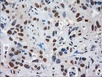 AFP Antibody in Immunohistochemistry (Paraffin) (IHC (P))