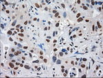 AFP Antibody in Immunohistochemistry (Paraffin) (IHC (P))