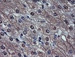 AFP Antibody in Immunohistochemistry (Paraffin) (IHC (P))