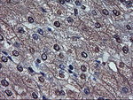 AFP Antibody in Immunohistochemistry (Paraffin) (IHC (P))