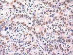 AFP Antibody in Immunohistochemistry (Paraffin) (IHC (P))