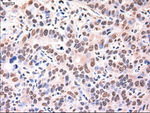 AFP Antibody in Immunohistochemistry (Paraffin) (IHC (P))