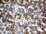 AFP Antibody in Immunohistochemistry (Paraffin) (IHC (P))