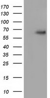 AFP Antibody in Western Blot (WB)