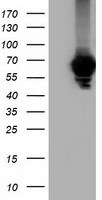 AFP Antibody in Western Blot (WB)