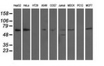 AFP Antibody in Western Blot (WB)
