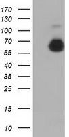 AFP Antibody in Western Blot (WB)