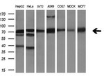AFP Antibody in Western Blot (WB)